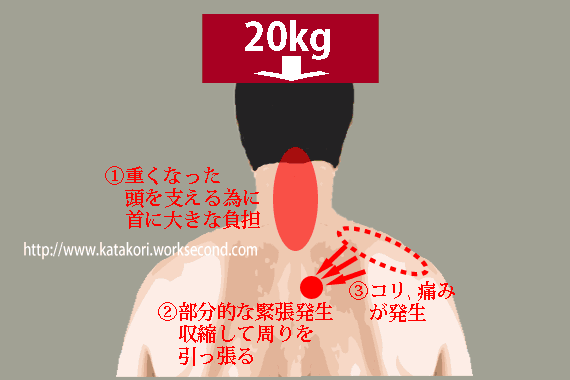 肩こり発生の仕組み